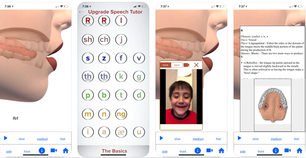 語(yǔ)言治療APP開(kāi)發(fā)